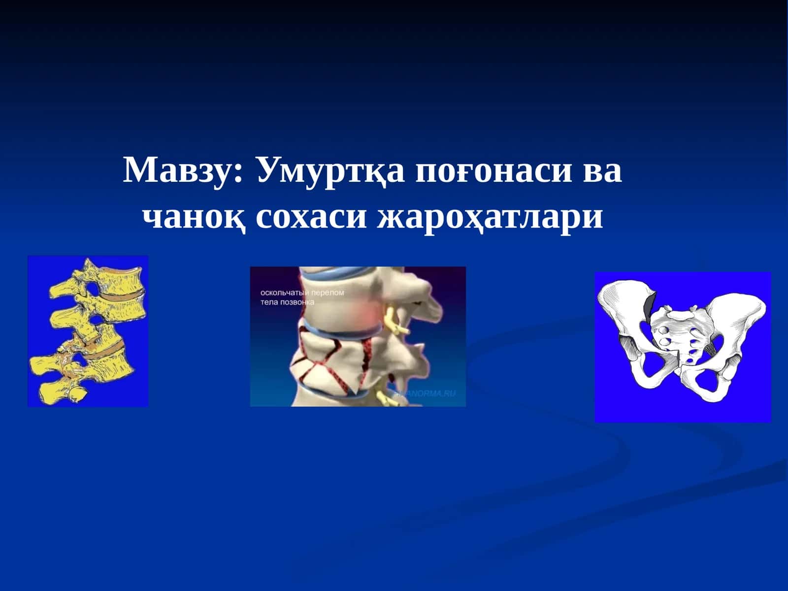 Умуртқа поғонаси ва чаноқ сохаси жароҳатлари