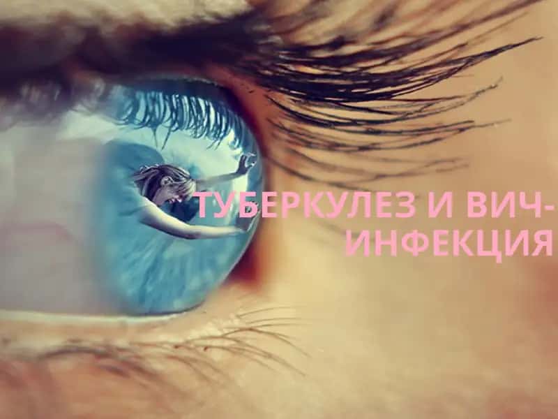 Туберкулез и ВИЧ-инфекция