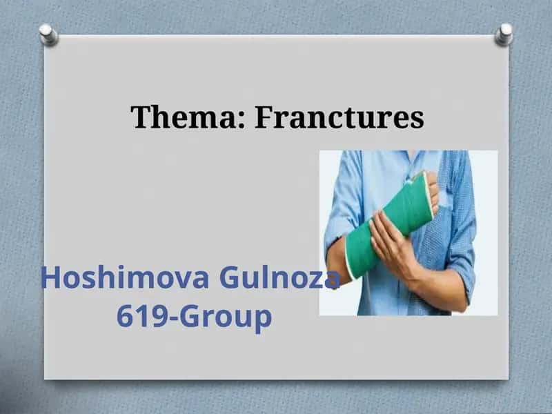 Bone fracture