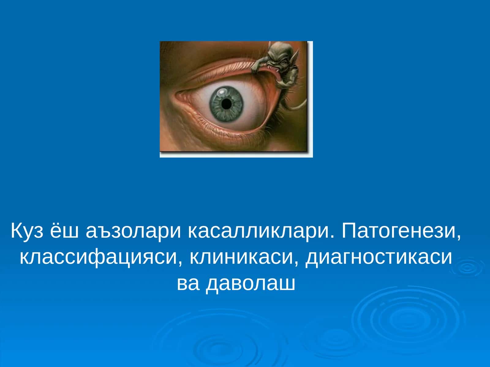 Кузёш аъзолари касалликлари. Патогенези, классифацияси, клиникаси, диагностикаси ва даволаш