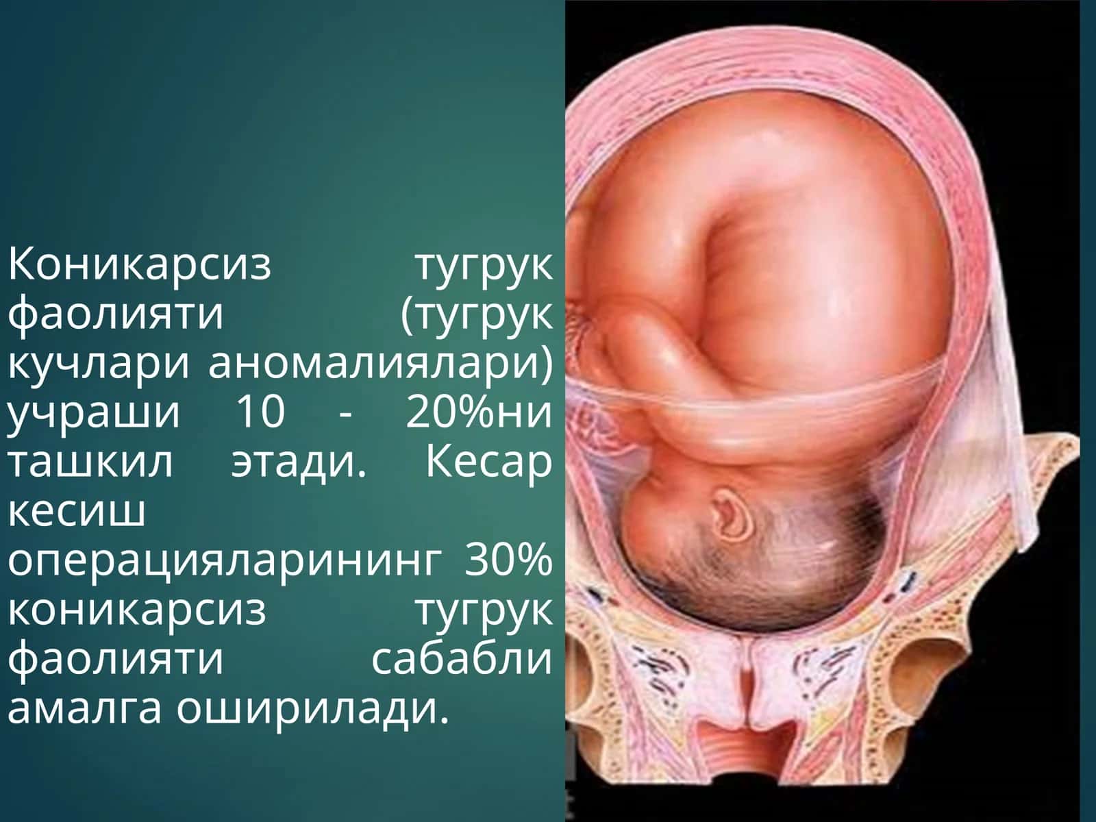 Коникарсиз тугрук фаолияти