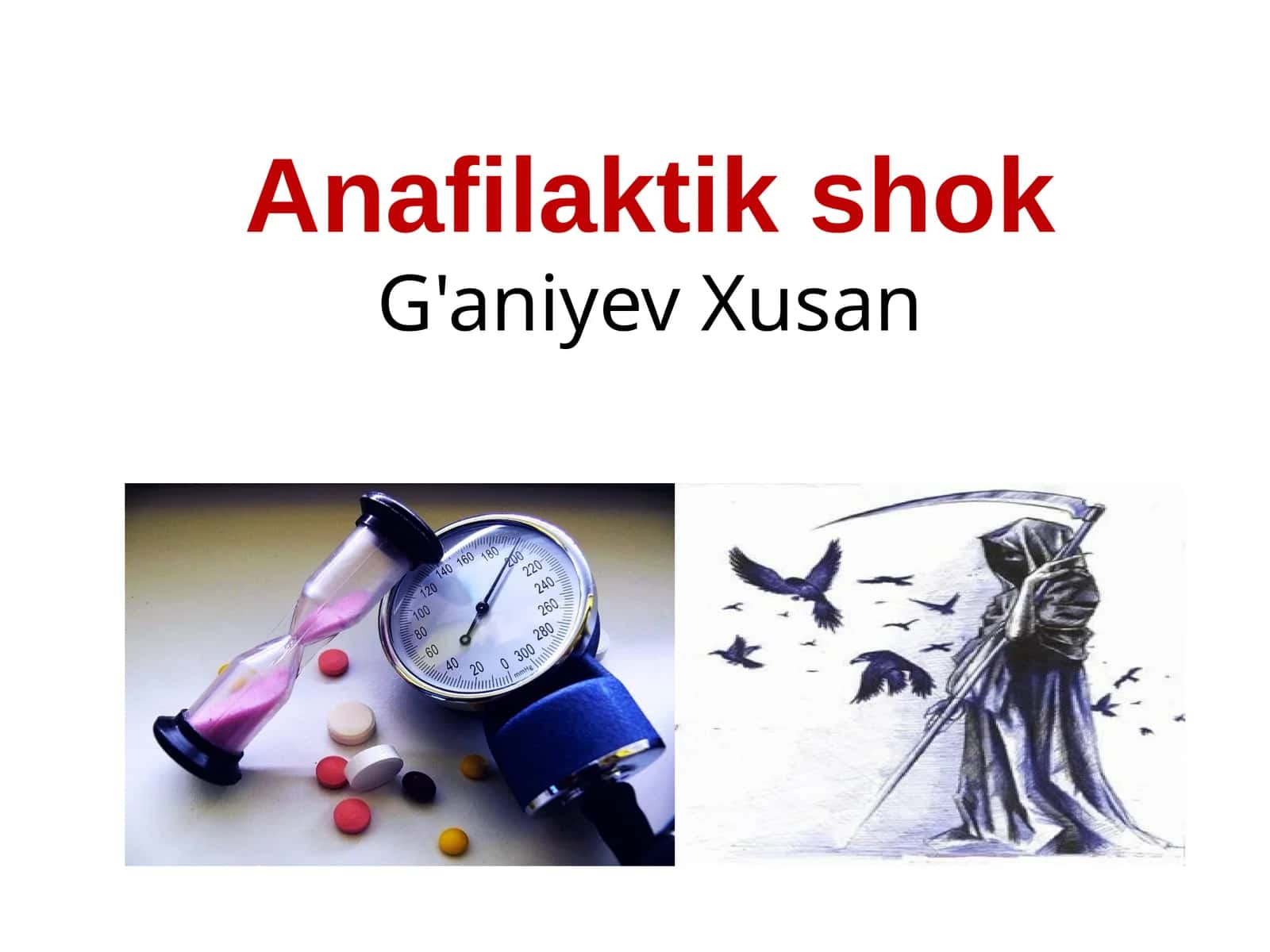 Anafilaktik shok