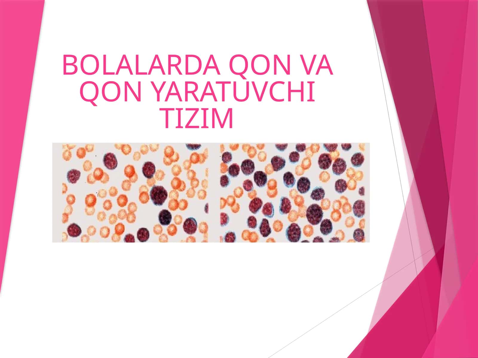 BOLALARDA QON VA QON YARATUVCHI TIZIM