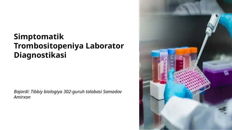 Simptomatik Trombositopeniya Laborator Diagnostikasi