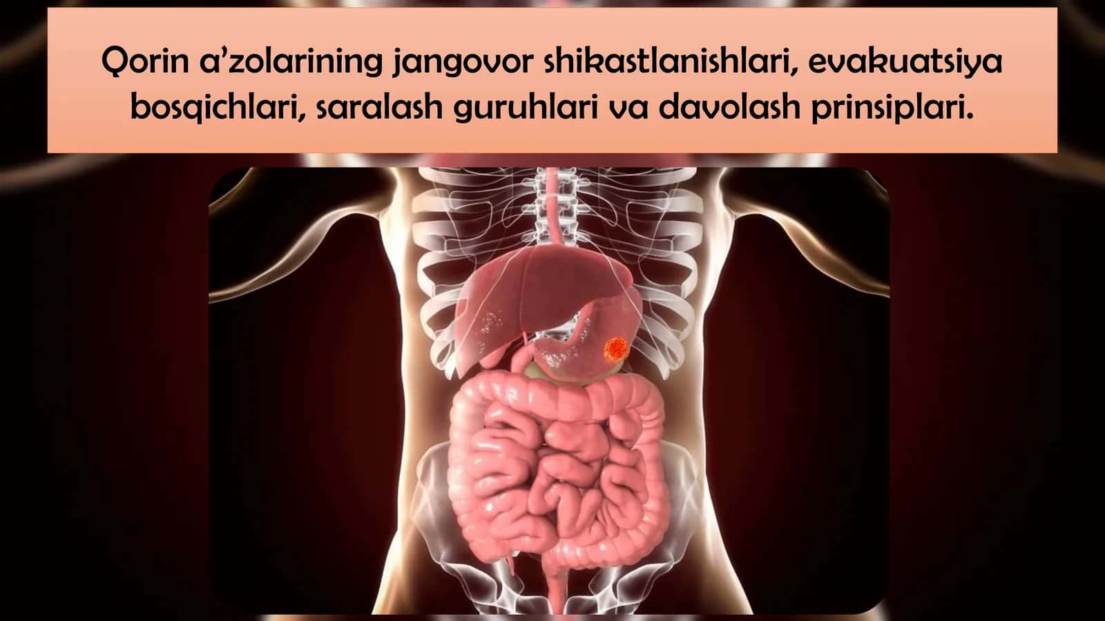 Qorin a’zolarining jangovor shikastlanishlari, evakuatsiya bosqichlari, saralash guruhlari va davolash prinsiplari