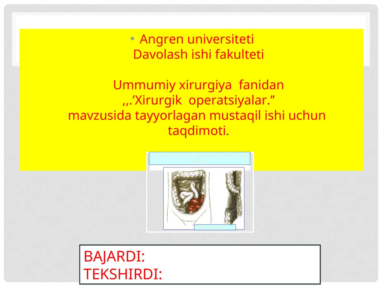 Xirurgik operatsiyalar