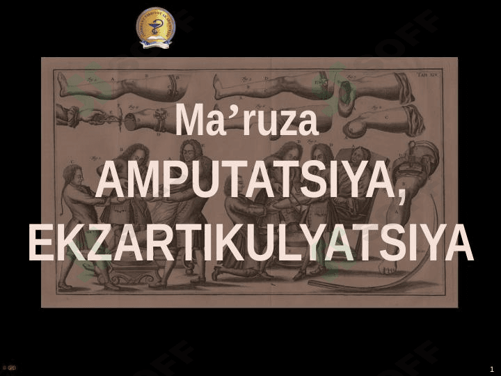 AMPUTATSIYA, EKZARTIKULYATSIYA
