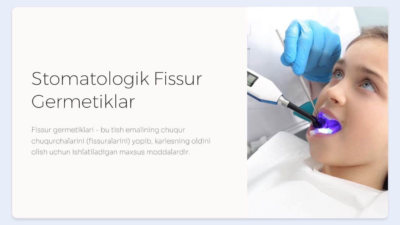 Fissur germetiklar.  Qo‘llash texnikasi.