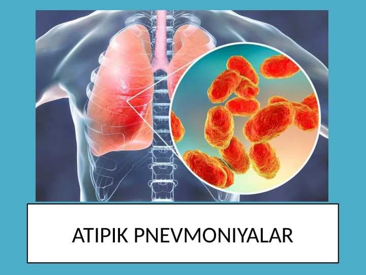 ATIPIK PNEVMONIYALAR