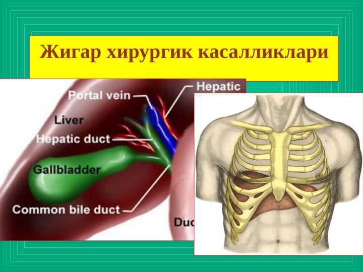 Jigar kasallilar ppt