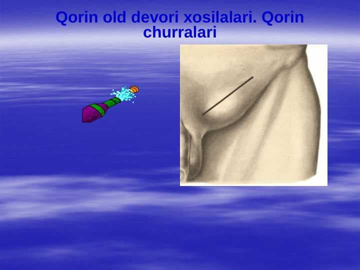 Qorin old devori xosilalari. Qorin churralari
