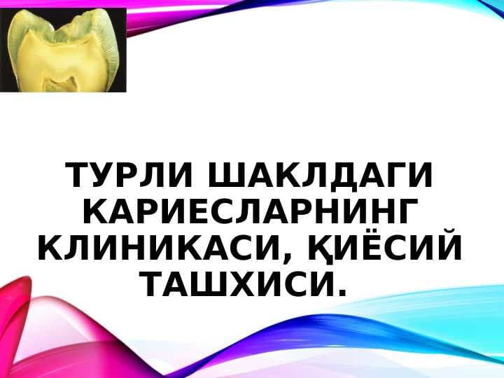 TISHKARIESNI  TASHXISLASH VA DAVOLASH