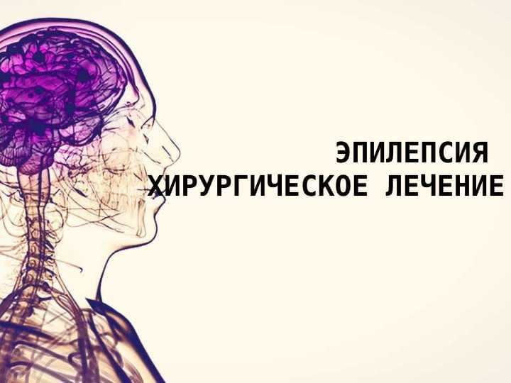 Эпилепсия хирургическое лечение