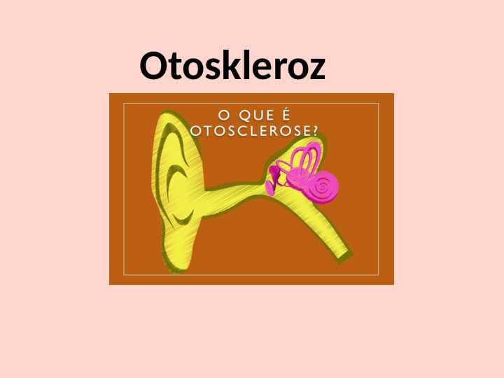 Otoskleroz