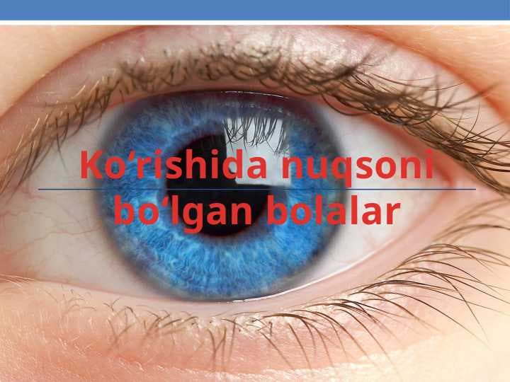 Ko‘rishida nuqsoni bo‘lgan bolalar