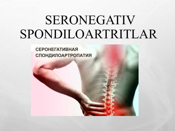 SERONEGATIV SPONDILOARTRITLAR