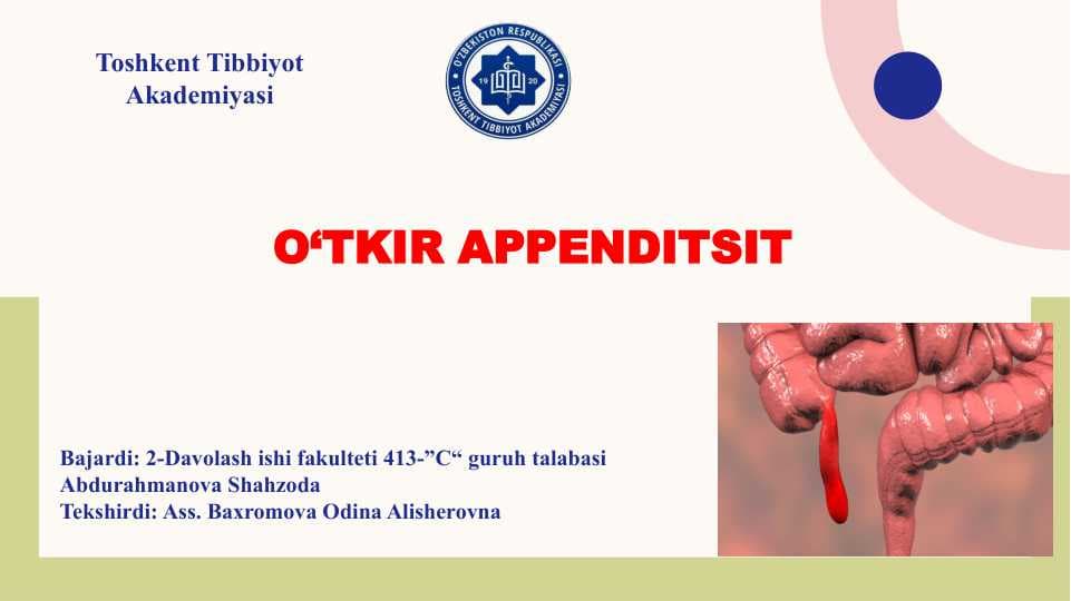 Appenditsit