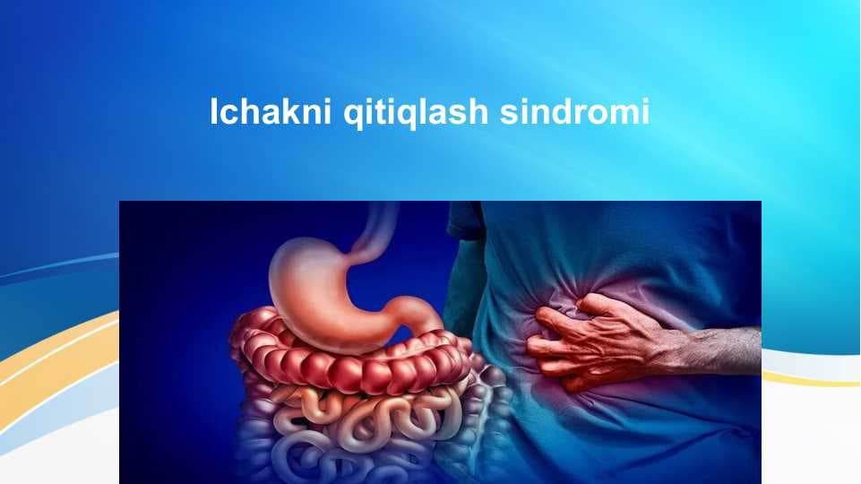 Ichakni qitiqlash sindromi . Irritable bowel syndrome
