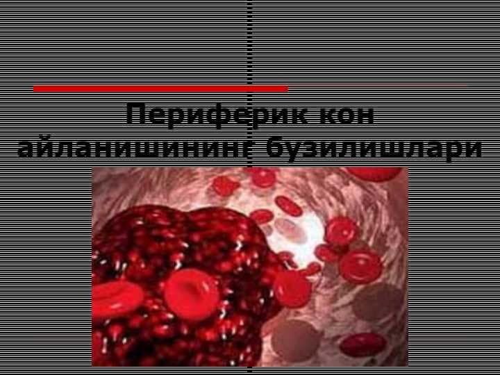 PERIFERIK QON AYLANISHINING BUZILISHLARI
