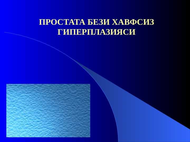 ПРОСТАТА БЕЗИ ХАВФСИЗ ГИПЕРПЛАЗИЯСИ