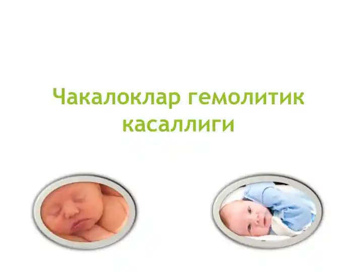 Чакалоклар гемолитик касаллиги