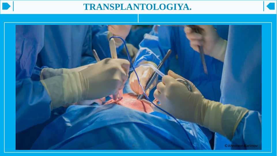 TRANSPLANTOLOGIYA