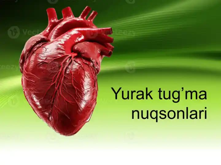 Yurak tug’ma nuqsonlari Юрак тугма нуксонлари
