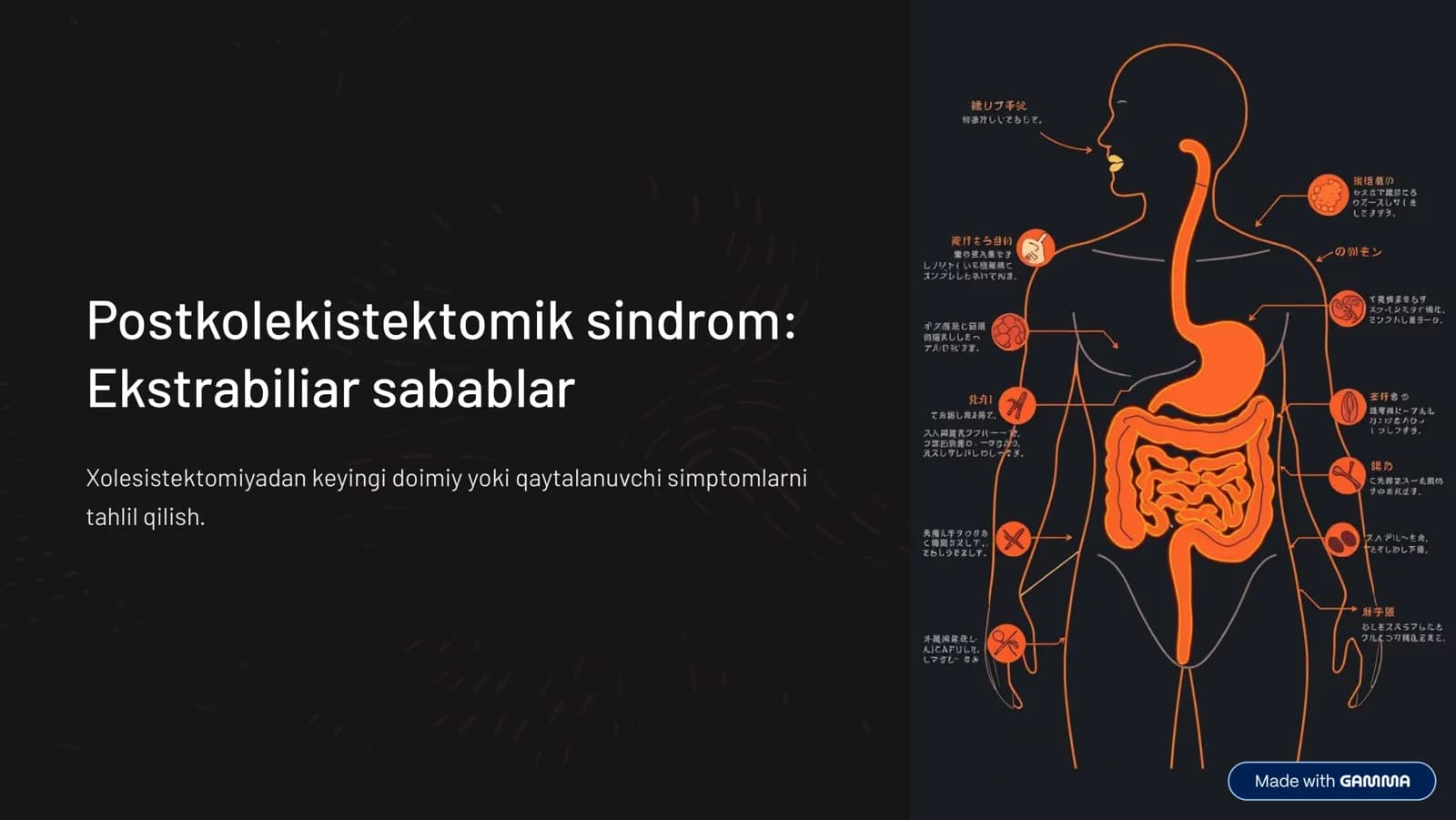 Postkolekistektomik sindrom