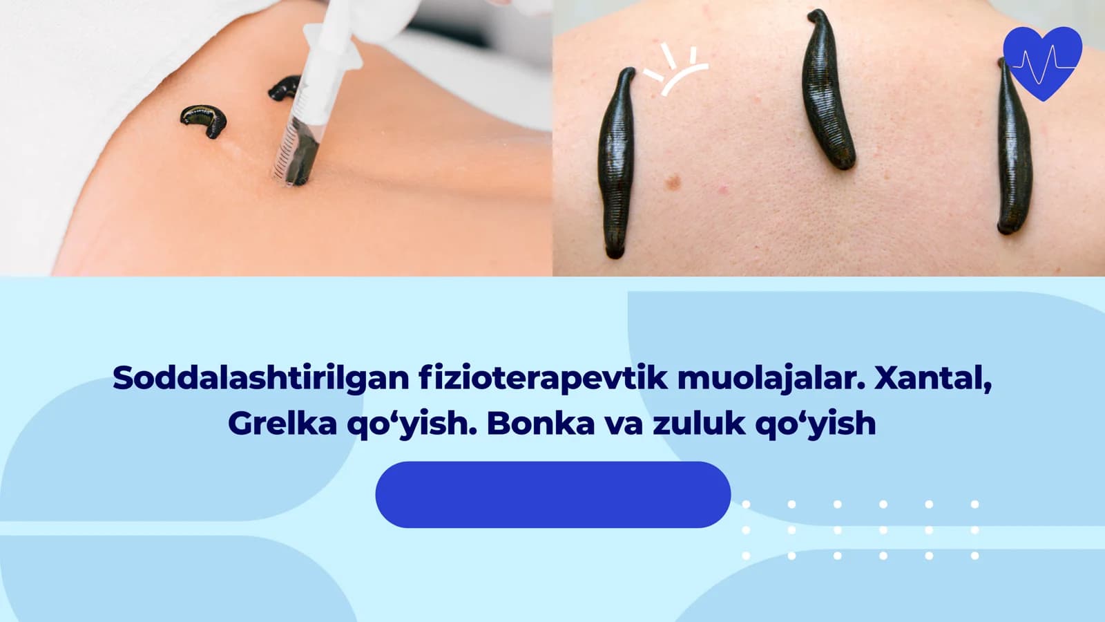 Fizioterapevtik muolajalar