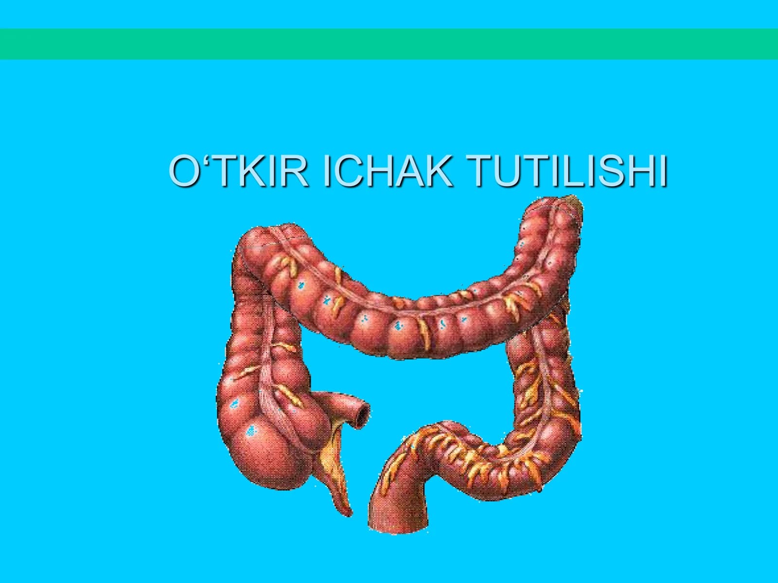 Ichak tutilishi