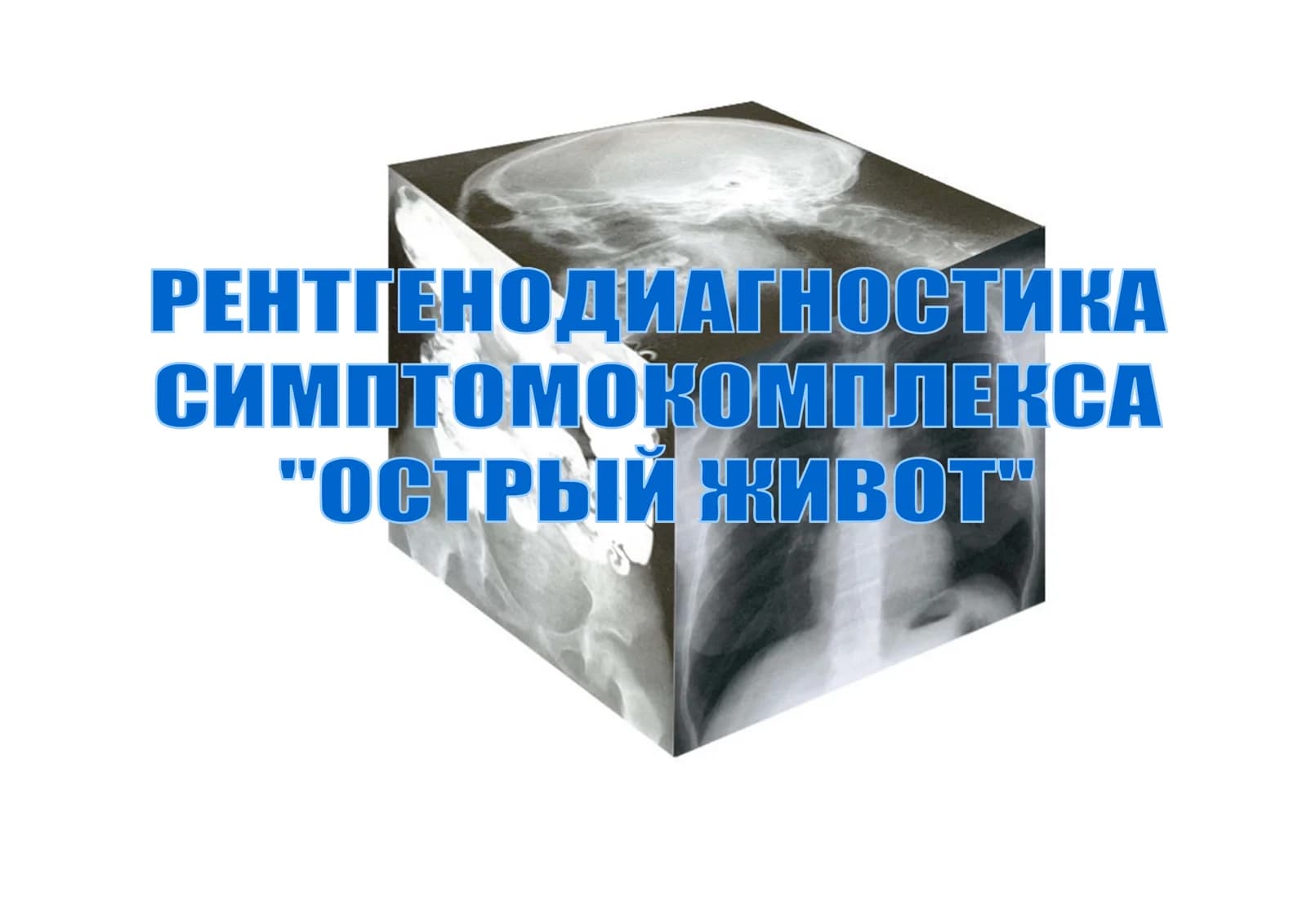 Прободение язвы или опухоли ЖКТ
