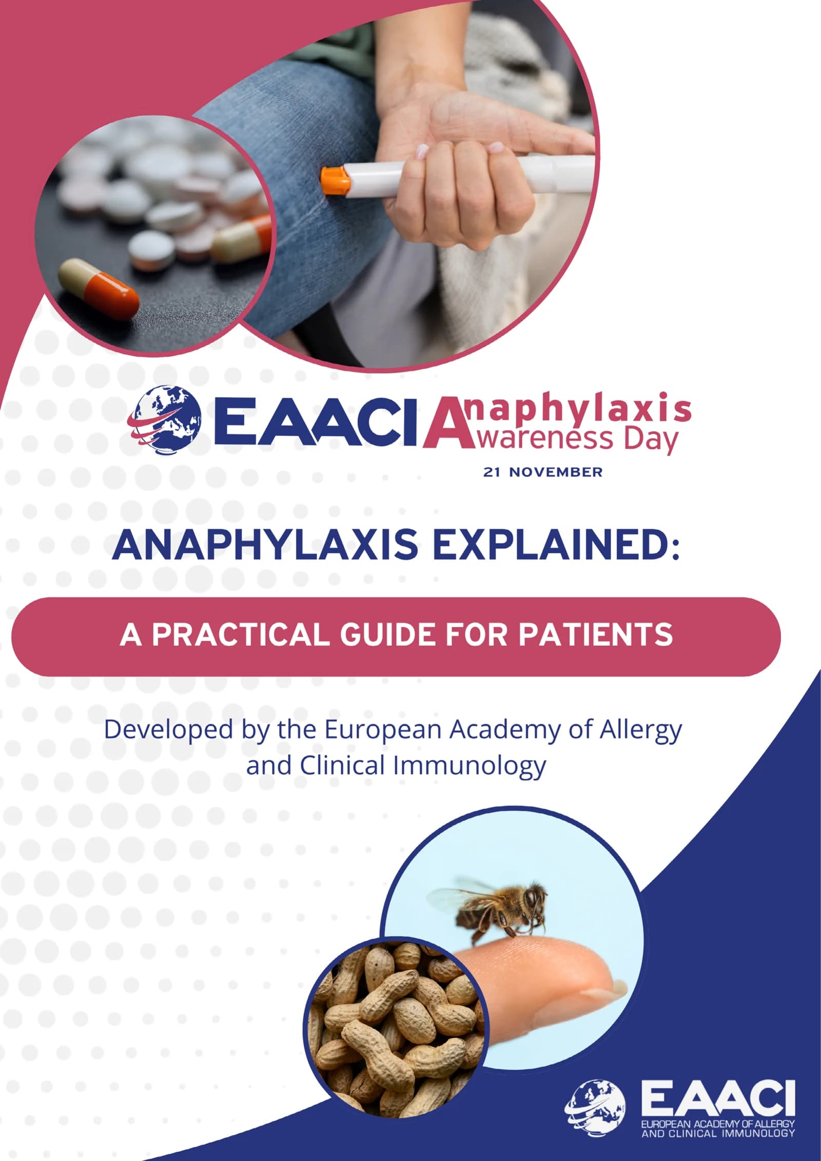 Anaphylaxis Анафилакция