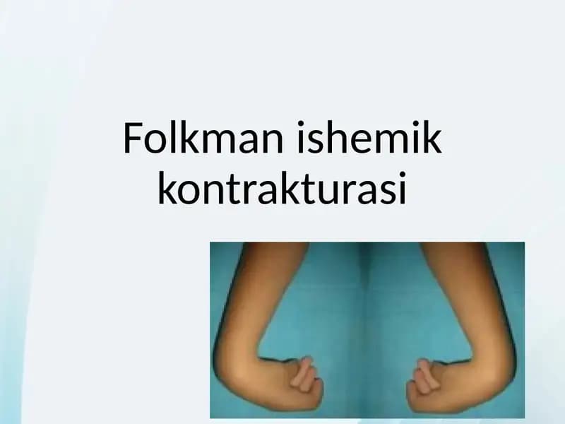 Folkman ishemik kontrakturasi