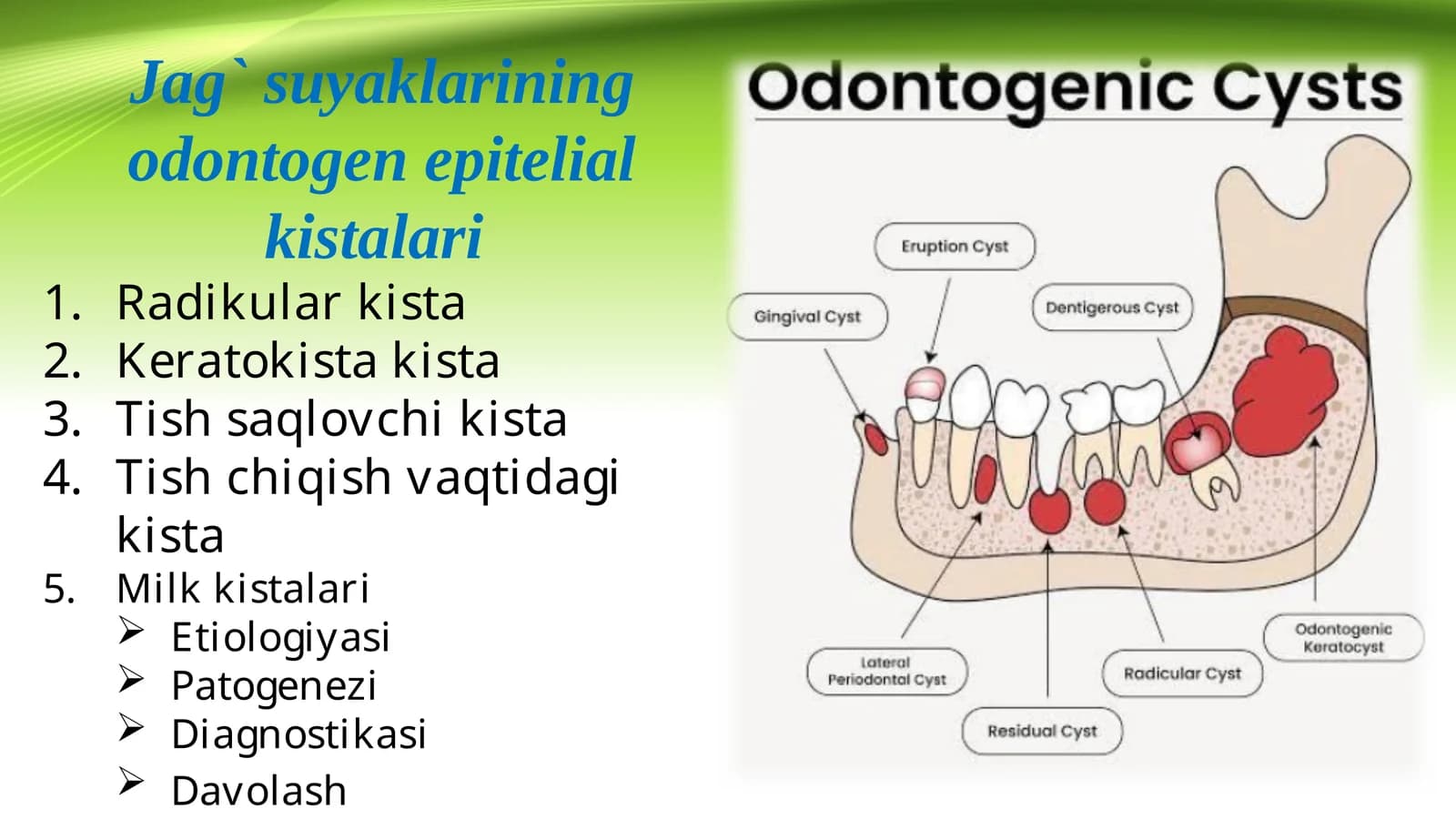 Jag` suyaklarining odontogen epitelial kistalari