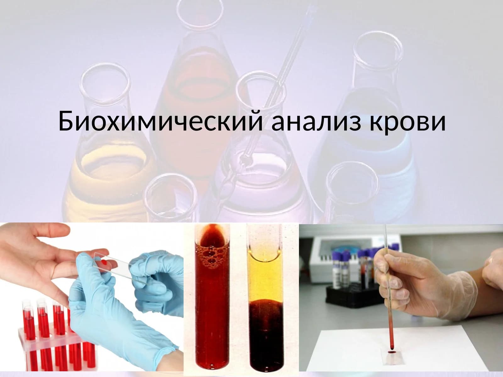 Биохимический анализ крови