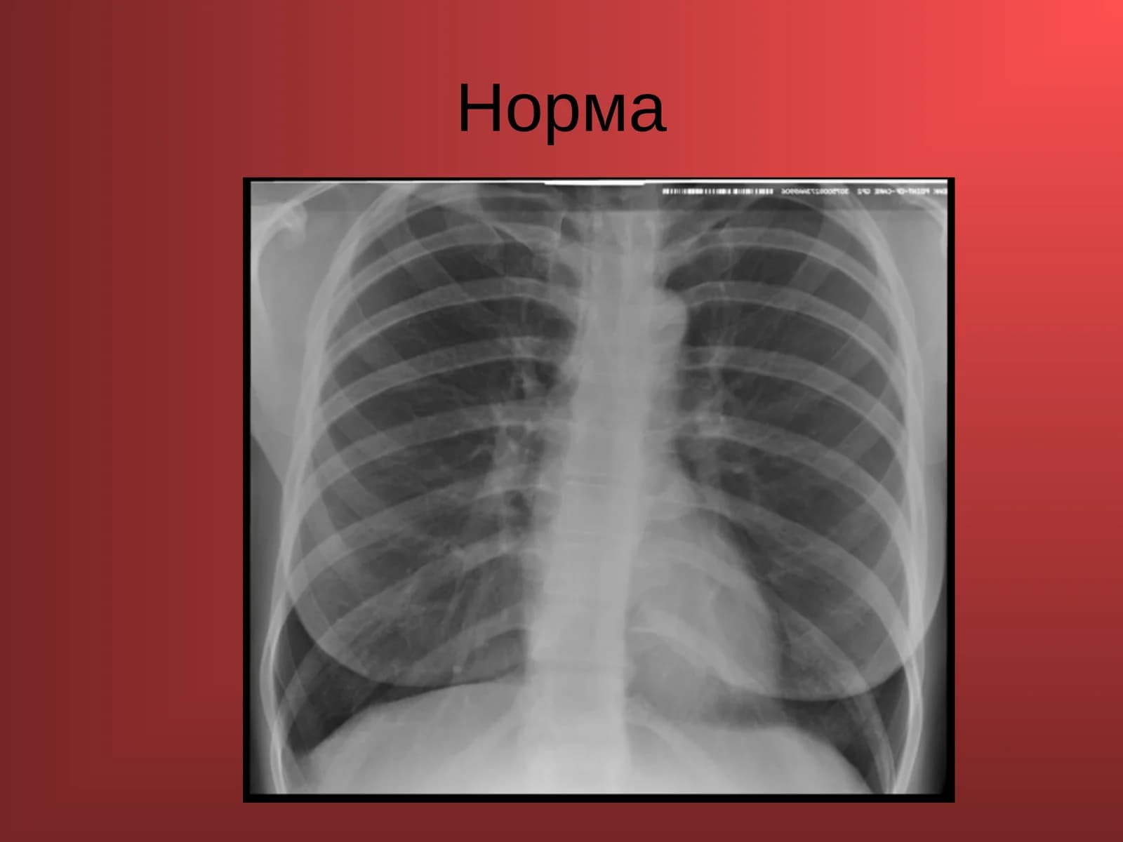 Норма