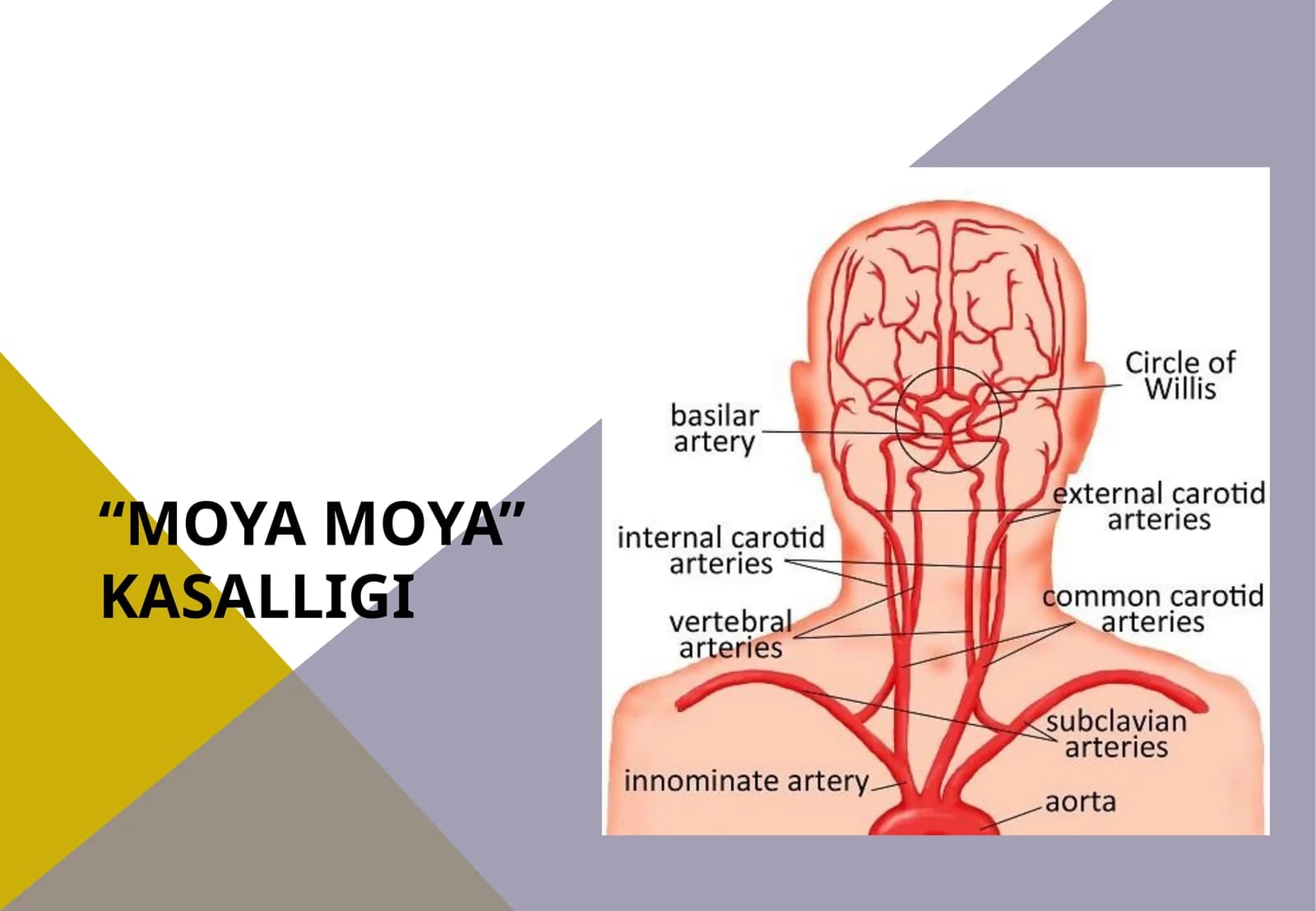 Moya moya kasalligi