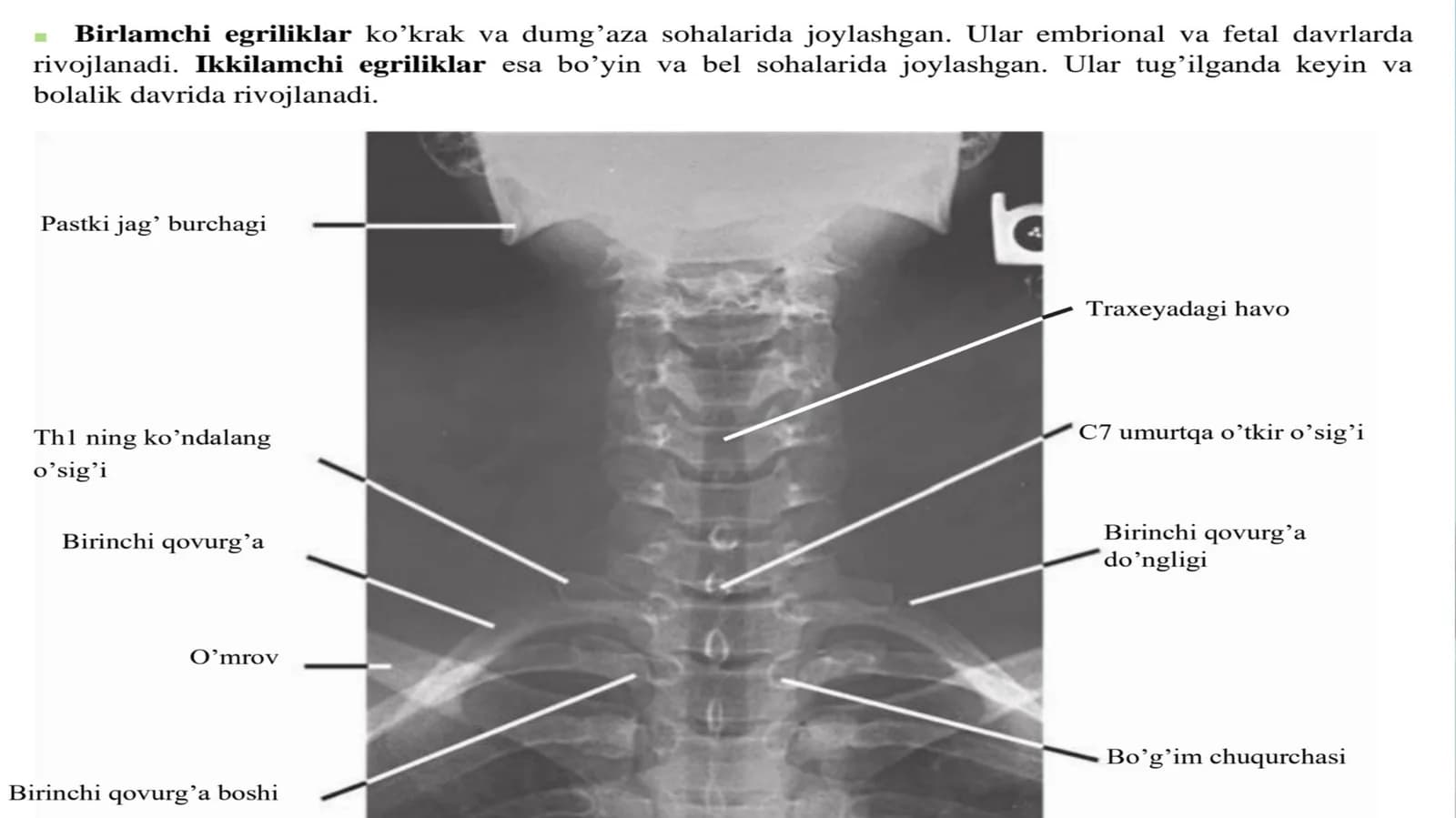 Umurtqapog'onasiningabnormalegriliklari