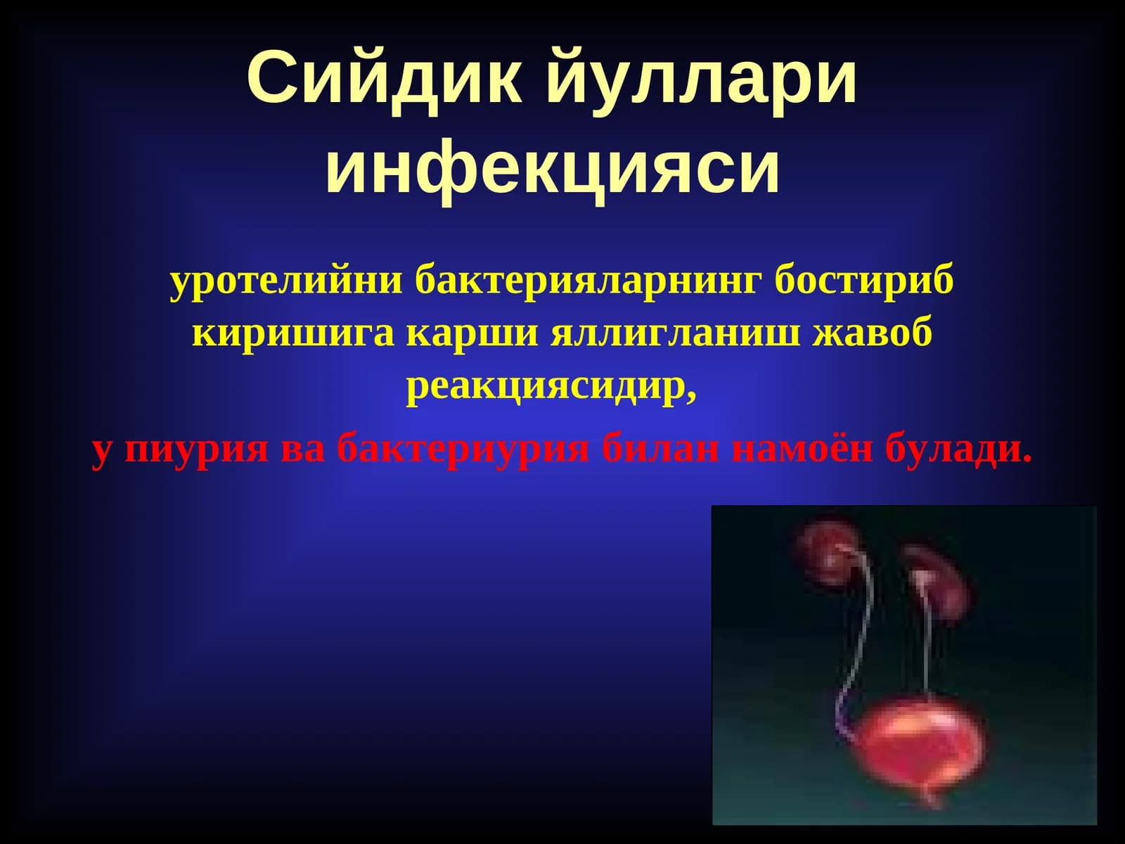 Сийдик йуллари инфекцияси