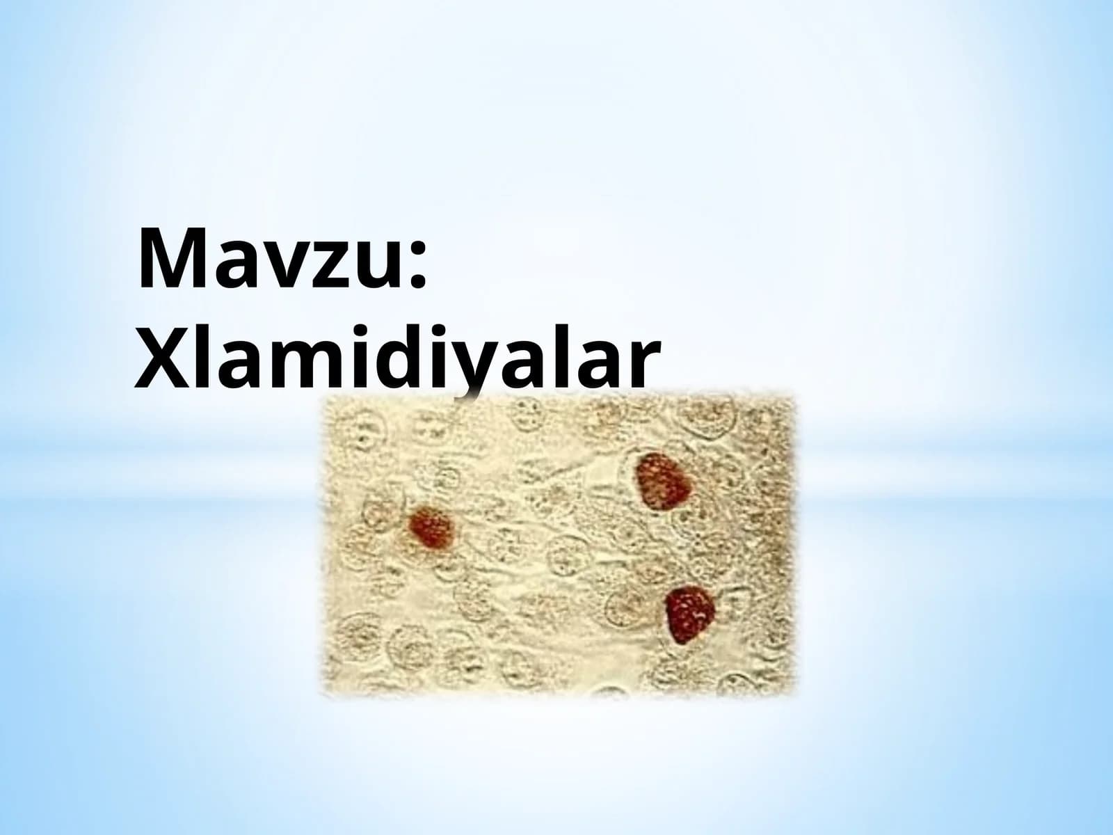 Xlamidiyalar