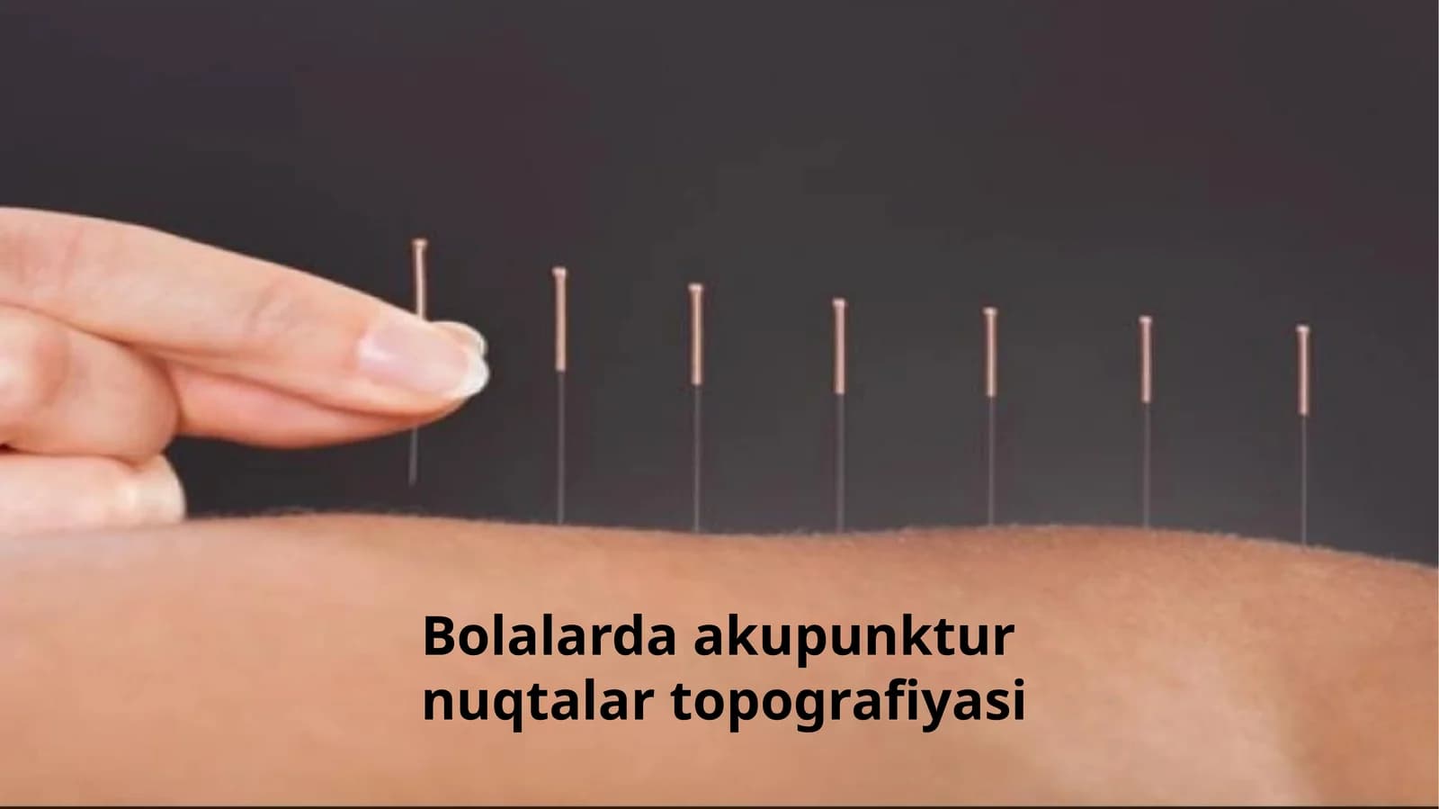 Bolalarda acupuncture nuqtalar topografiyasi