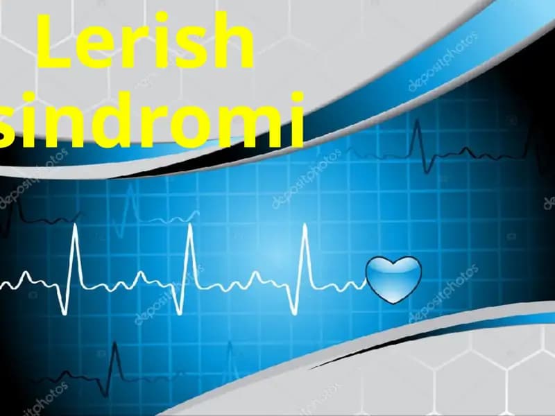 Lerish sindromi yurak