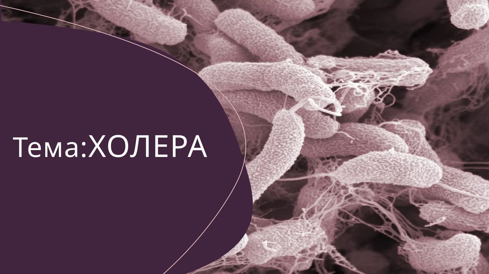 Тема:ХОЛЕРА