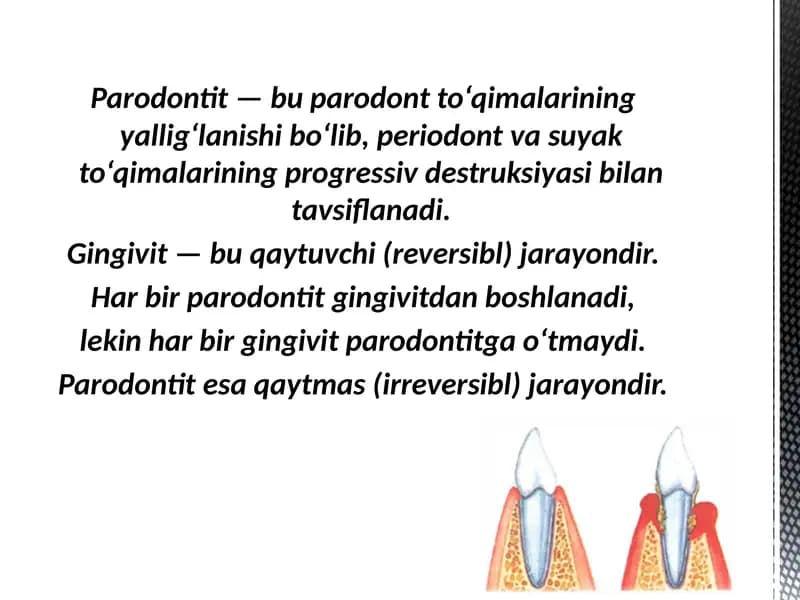 Parodontitlar . Yengil shakli va Gingivit qiyosiy tashxisi