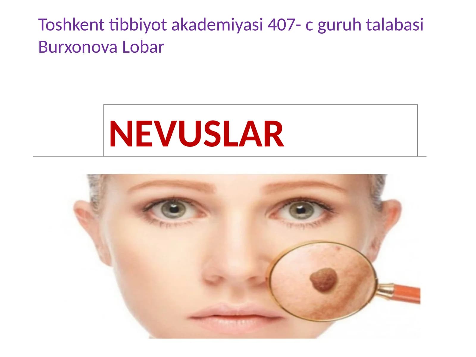 NEVUSLAR