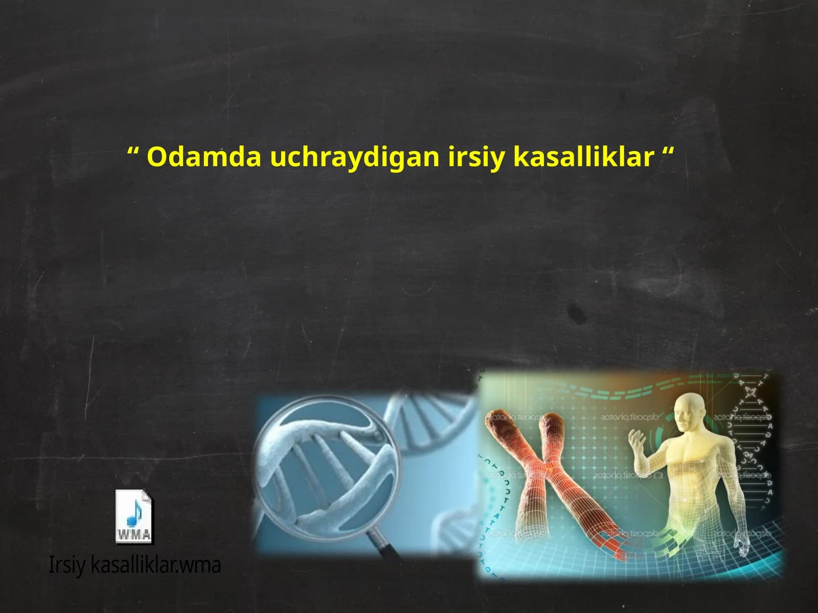 Odamda uchraydigan irsiy kasalliklar