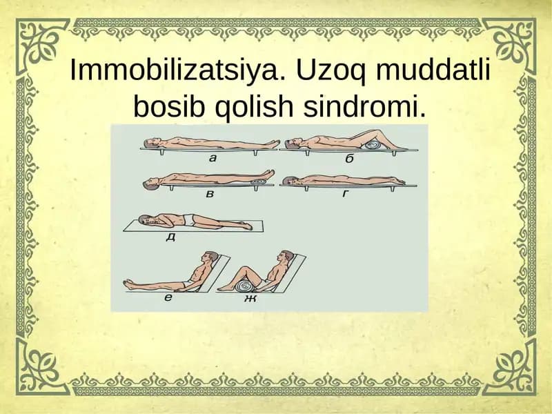 Immobilizatsiya.Uzoq muddatli bosib qolish sindromi
