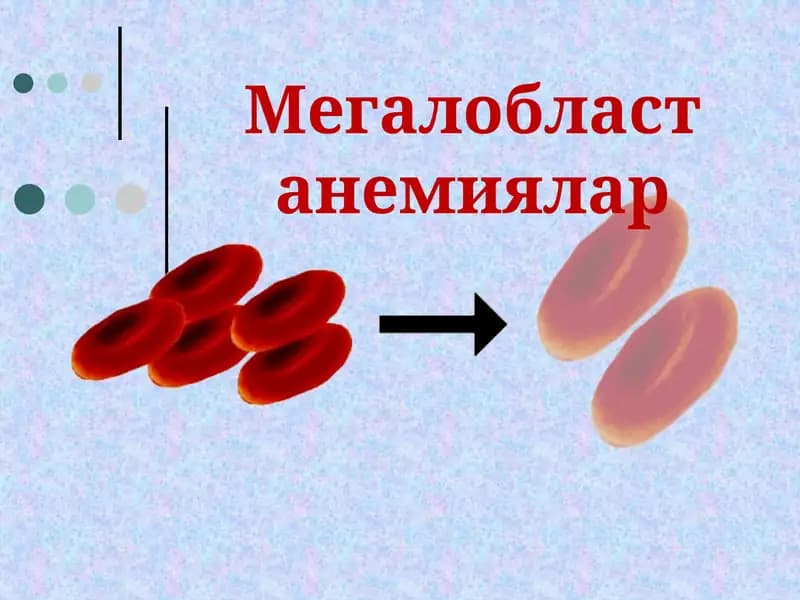 Мегалобласт  анемиялар