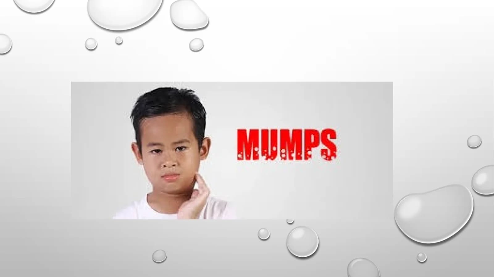 Mumps
