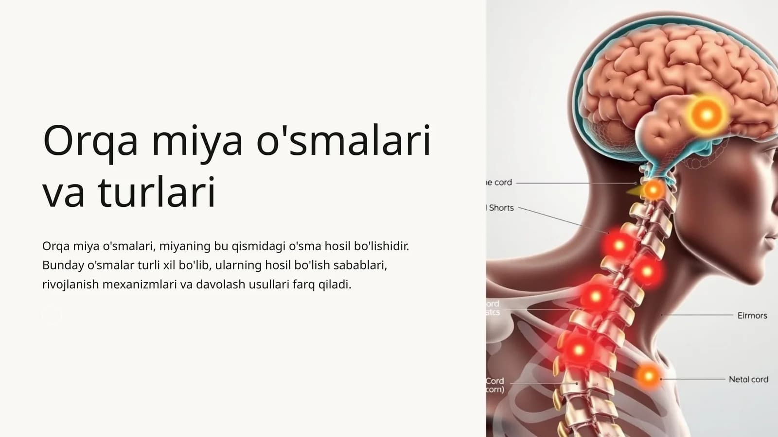 Orqa miya o'smalari va turlari